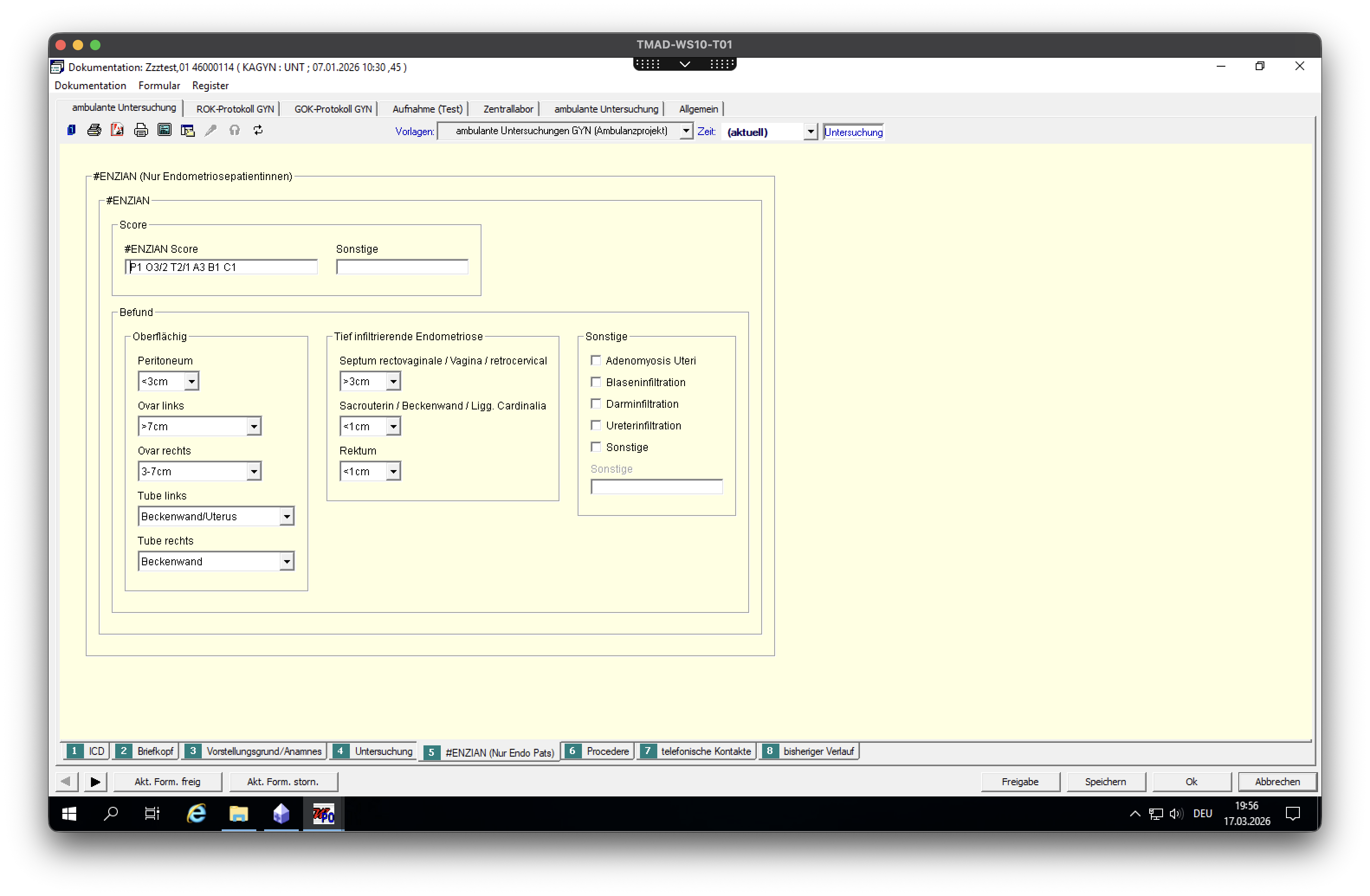 Endometriose: Ambulante Untersuchungsmaske 2